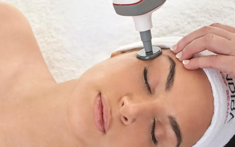 INDIBA Facial – Tratamiento Avanzado de Radiofrecuencia